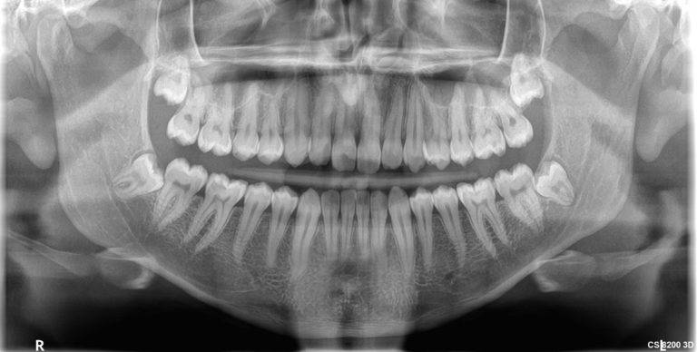 Pulse Dental Digital Xray