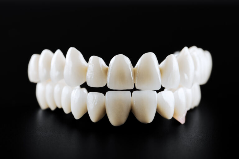 Issue with crown or Bridge Call Pulse Dental, Houston,TX